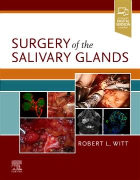 Witt |  Surgery of the Salivary Glands | Buch |  Sack Fachmedien
