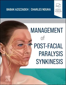 Azizzadeh / Nduka |  Management of Post-Facial Paralysis Synkinesis | Buch |  Sack Fachmedien