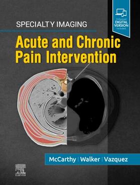 McCarthy / Walker / Vazquez |  Specialty Imaging: Acute and Chronic Pain Intervention | Buch |  Sack Fachmedien