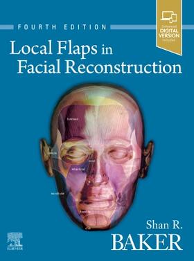 Baker |  Local Flaps in Facial Reconstruction | Buch |  Sack Fachmedien