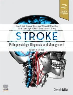 Grotta / Albers / Broderick |  Stroke | Buch |  Sack Fachmedien