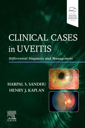 Sandhu / Kaplan |  Clinical Cases in Uveitis | Buch |  Sack Fachmedien