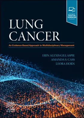 Gillaspie / Horn / Cass |  Lung Cancer | Buch |  Sack Fachmedien