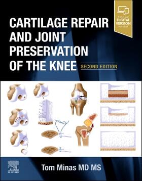 Minas |  Cartilage Repair and Joint Preservation of the Knee | Buch |  Sack Fachmedien
