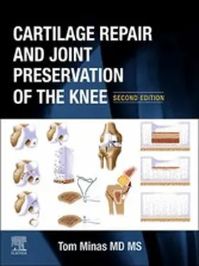 Minas |  Cartilage Repair and Joint Preservation of the Knee | eBook | Sack Fachmedien