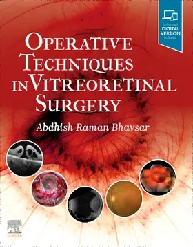 Bhavsar |  Operative Techniques in Vitreoretinal Surgery | Buch |  Sack Fachmedien