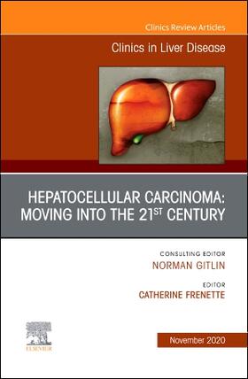 Frenette |  Hepatocellular Carcinoma: Moving Into the 21st Century, an Issue of Clinics in Liver Disease | Buch |  Sack Fachmedien