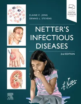 Stevens / Jong |  Netter's Infectious Diseases | Buch |  Sack Fachmedien