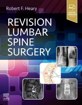 Heary |  Revision Lumbar Spine Surgery | Buch |  Sack Fachmedien