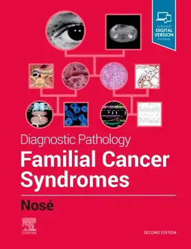 Nosé |  Diagnostic Pathology: Familial Cancer Syndromes | Buch |  Sack Fachmedien