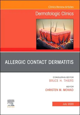 Mowad |  Allergic Contact Dermatitis, an Issue of Dermatologic Clinics | Buch |  Sack Fachmedien