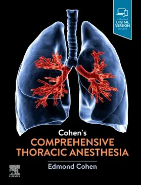 Cohen |  Cohen's Comprehensive Thoracic Anesthesia | Buch |  Sack Fachmedien