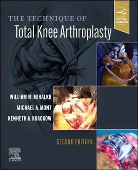 Krackow / Mihalko / Mont |  The Technique of Total Knee Arthroplasty | Buch |  Sack Fachmedien