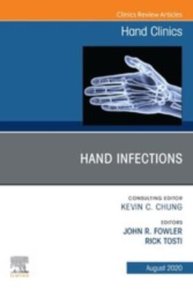Fowler / Tosti |  Hand Infections, An Issue of Hand Clinics, E-Book | eBook | Sack Fachmedien