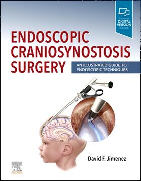 Jimenez |  Endoscopic Craniosynostosis Surgery | Buch |  Sack Fachmedien