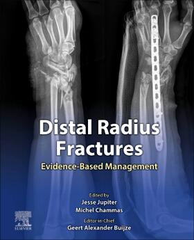 Buijze / Jupiter / Chammas |  Distal Radius Fractures | Buch |  Sack Fachmedien