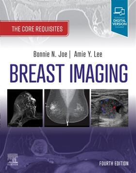 Joe / Lee |  Breast Imaging | Buch |  Sack Fachmedien