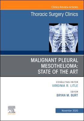 Burt |  Malignant Pleural Mesothelioma, an Issue of Thoracic Surgery Clinics | Buch |  Sack Fachmedien