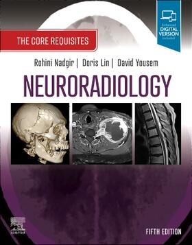 Nadgir / Lin / Yousem |  Neuroradiology | Buch |  Sack Fachmedien