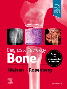 Nielsen / Rosenberg |  Diagnostic Pathology: Bone | Buch |  Sack Fachmedien