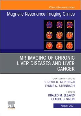 Elsayes / Sirlin |  MR Imaging of Chronic Liver Diseases and Liver Cancer, an Issue of Magnetic Resonance Imaging Clinics of North America | Buch |  Sack Fachmedien