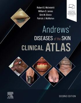 Micheletti / James / Elston |  Andrews' Diseases of the Skin Clinical Atlas | Buch |  Sack Fachmedien