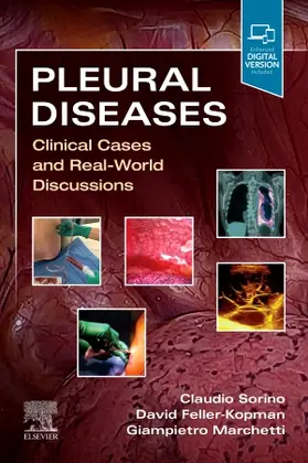 Sorino / Feller-Kopman / Marchetti |  Pleural Diseases | Buch |  Sack Fachmedien