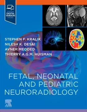 Meoded / Kralik / Desai |  Fetal, Neonatal and Pediatric Neuroradiology | Buch |  Sack Fachmedien