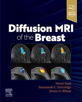 Le Bihan / Iima / Partridge |  Diffusion MRI of the Breast | Buch |  Sack Fachmedien