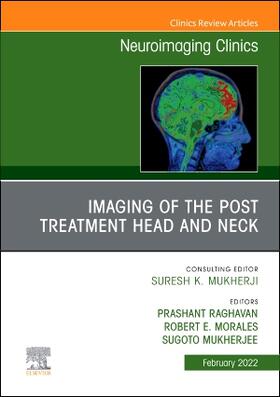 Raghavan / Morales / Mukherjee |  Imaging of the Post Treatment Head and Neck, an Issue of Neuroimaging Clinics of North America | Buch |  Sack Fachmedien
