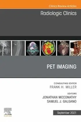 Galgano MD |  PET Imaging, An Issue of Radiologic Clinics of North America, E-Book | eBook | Sack Fachmedien