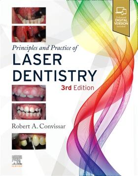 Convissar |  Principles and Practice of Laser Dentistry | Buch |  Sack Fachmedien