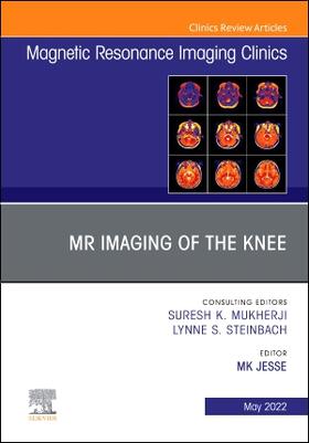 Jesse |  MR Imaging of The Knee, An Issue of Magnetic Resonance Imaging Clinics of North America | Buch |  Sack Fachmedien