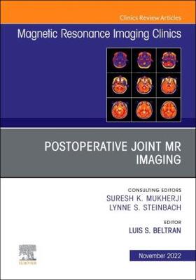 Beltran |  Postoperative Joint MR Imaging, an Issue of Magnetic Resonance Imaging Clinics of North America | Buch |  Sack Fachmedien