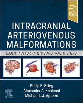 Khalessi / Apuzzo |  Intracranial Arteriovenous Malformations | Buch |  Sack Fachmedien