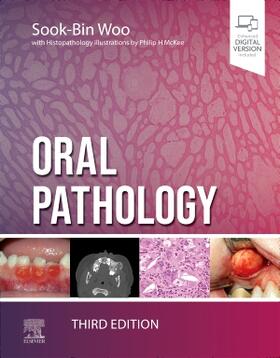 Woo |  Oral Pathology | Buch |  Sack Fachmedien