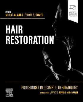 Dover / Alam |  Procedures in Cosmetic Dermatology: Hair Restoration | Buch |  Sack Fachmedien