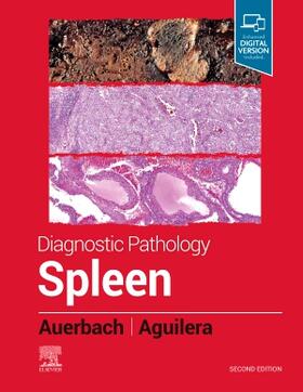 Auerbach / Aguilera |  Diagnostic Pathology: Spleen | Buch |  Sack Fachmedien