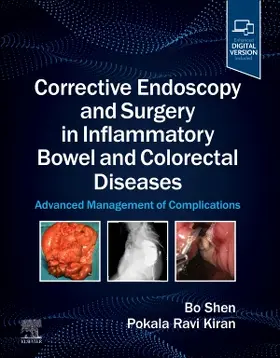 Shen / Kiran |  Corrective Endoscopy and Surgery in Inflammatory Bowel and Colorectal Diseases | Buch |  Sack Fachmedien