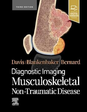 Blankenbaker / Davis / Bernard |  Diagnostic Imaging: Musculoskeletal Non-Traumatic Disease | Buch |  Sack Fachmedien