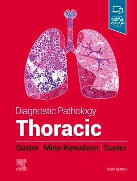 Suster / Mino-Kenudson |  Diagnostic Pathology: Thoracic | Buch |  Sack Fachmedien