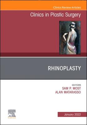 Most / Matarasso |  Rhinoplasty, an Issue of Clinics in Plastic Surgery | Buch |  Sack Fachmedien