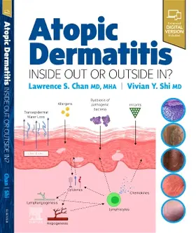 Chan / Shi |  Atopic Dermatitis: Inside Out or Outside In | Buch |  Sack Fachmedien