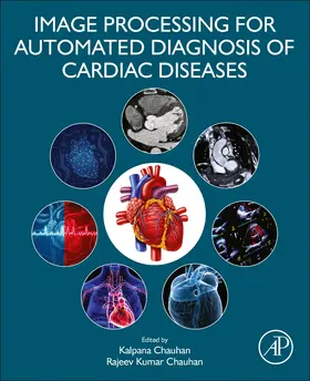 Chauhan | Image Processing for Automated Diagnosis of Cardiac Diseases | Buch | 978-0-323-85064-3 | sack.de