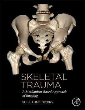 Bierry |  Skeletal Trauma | Buch |  Sack Fachmedien