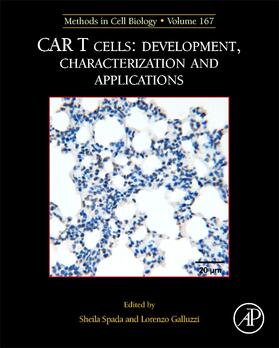 Spada |  MCB: CAR T Cells: Development, Characterization and Applications | Buch |  Sack Fachmedien