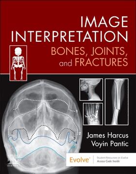 Harcus / Pantic |  Image Interpretation: Bones, Joints, and Fractures | Buch |  Sack Fachmedien