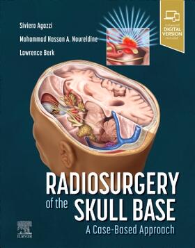 Agazzi / Berk / Noureldine |  Radiosurgery of the Skull Base: A Case-Based Approach | Buch |  Sack Fachmedien