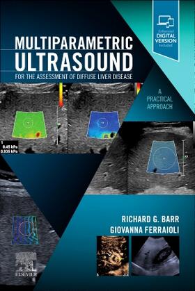 Ferraioli |  Multiparametric Ultrasound for the Assessment of Diffuse Liver Disease | Buch |  Sack Fachmedien