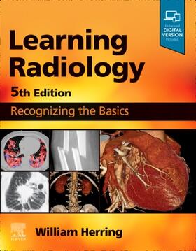 Herring |  Learning Radiology | Buch |  Sack Fachmedien